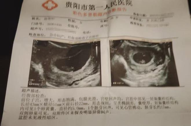 期孕妇担忧：害怕美味成“隐患”PG麻将胡了2模拟器火锅底料过(图4)